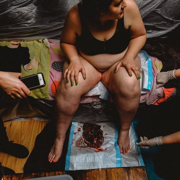 Fotógrafa fotografía a madres con sus placentas