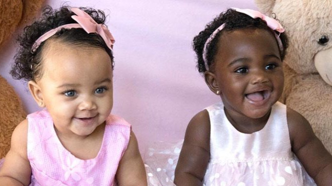 Gemelas con distinto color de piel 