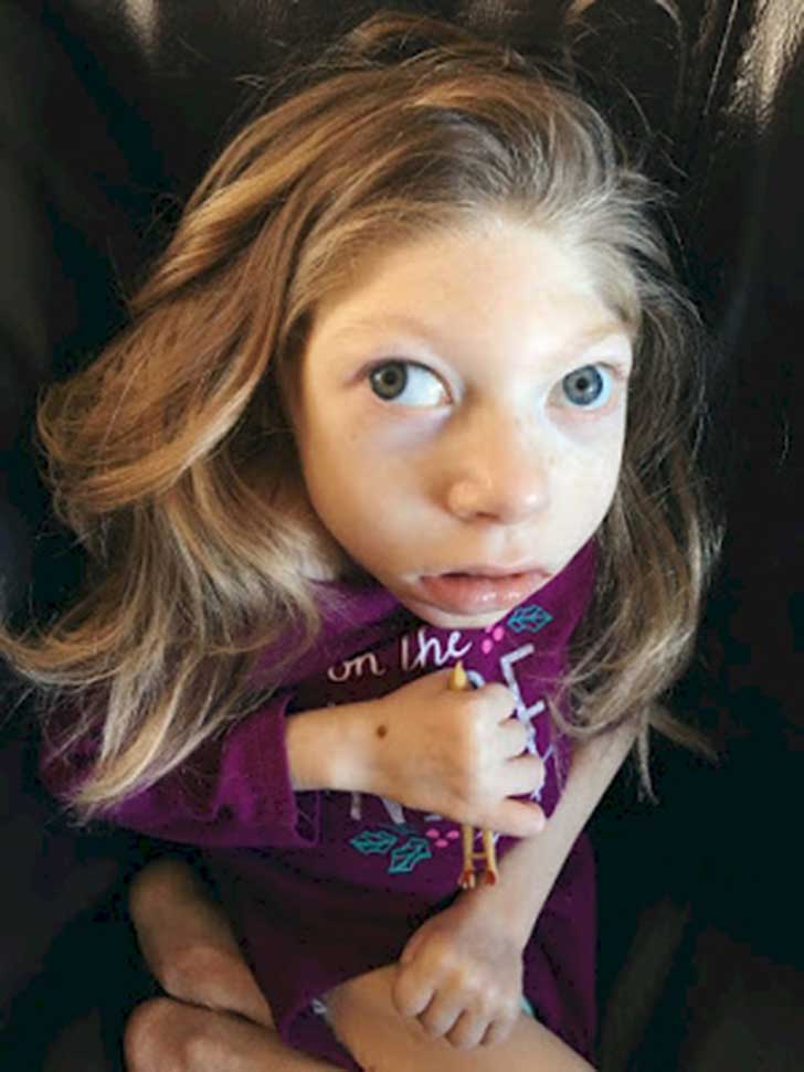 Hermanas con extraña enfermedad