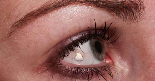 Implantes de joyas en los ojos