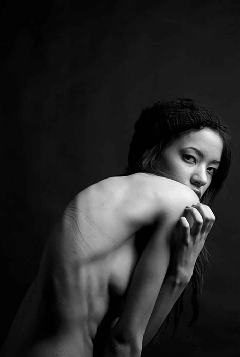 Ayesha Jones modelo con escoliosis