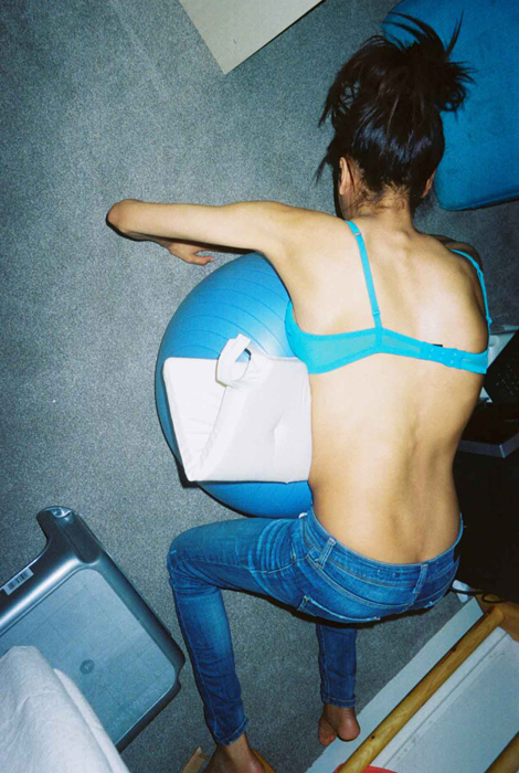 Ayesha Jones modelo con escoliosis