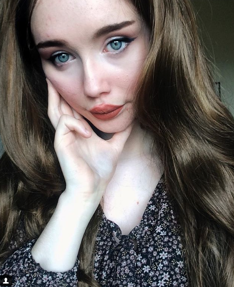 La instagramer Hailey Wait muestra su acné para luchar contra el canon de belleza