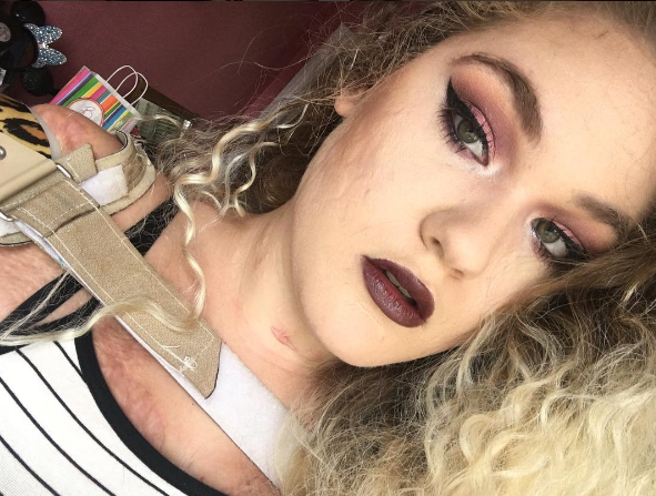 Kaitlyn Dobrow, bloguera sin extremidades