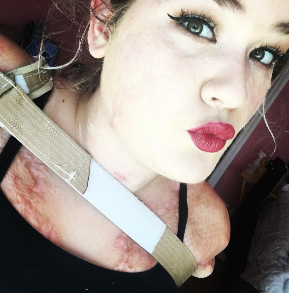 Kaitlyn Dobrow, bloguera sin extremidades