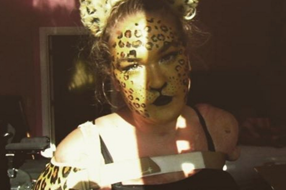 Kaitlyn Dobrow, bloguera sin extremidades