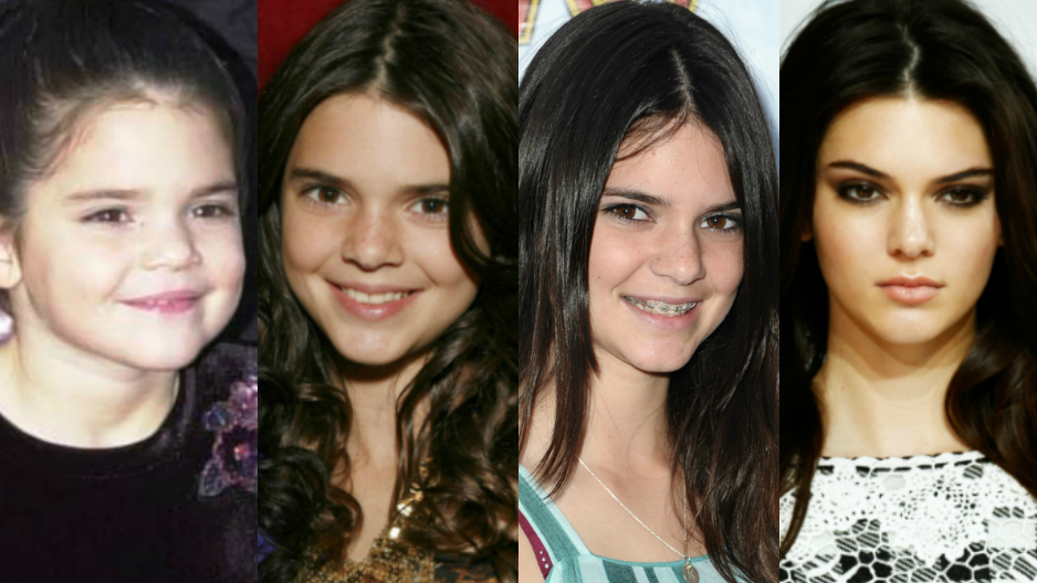 kylie Jenner antes y después