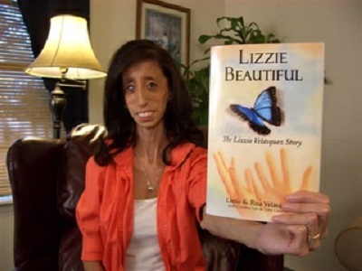 Lizzie Velasquez, 'la mujer más fea del mundo'