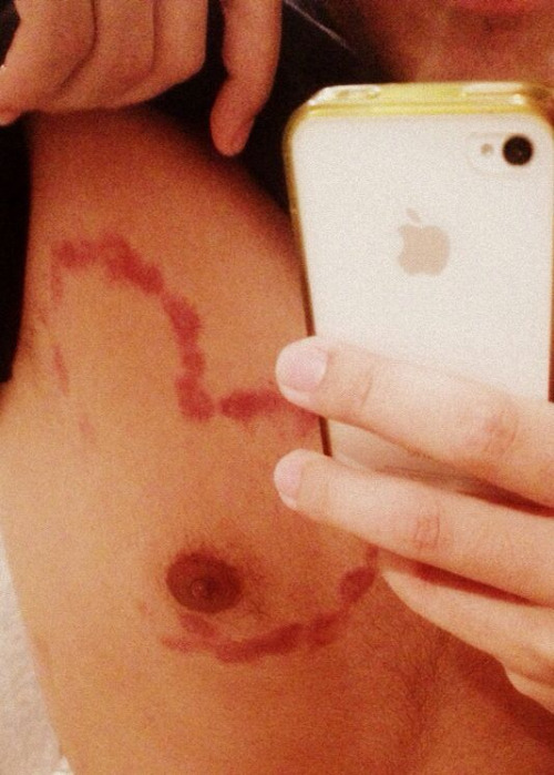 Chupetones peligrosos