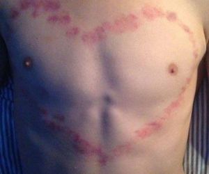 Chupetones peligrosos