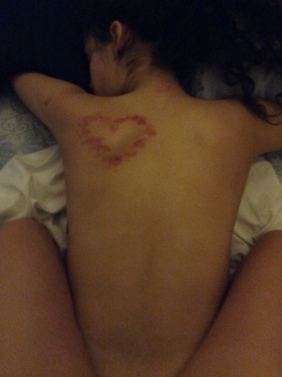 Chupetones peligrosos