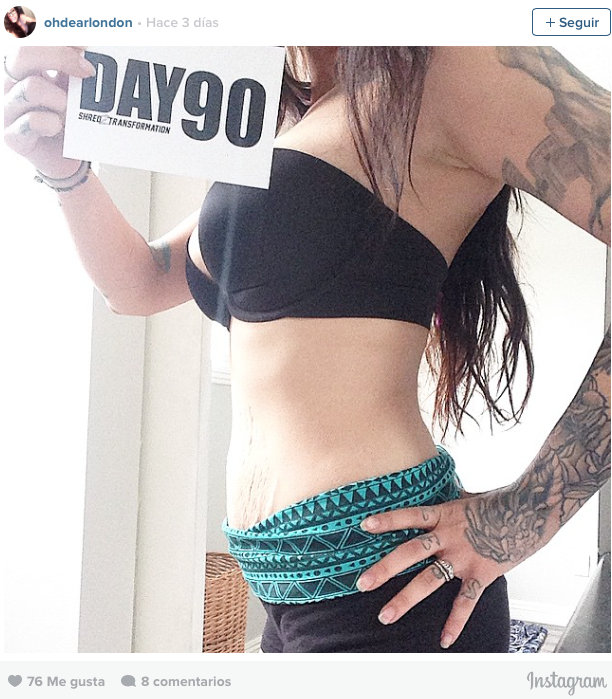 #LoveYourLines, mujeres con estrías