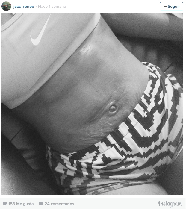 #LoveYourLines, mujeres con estrías