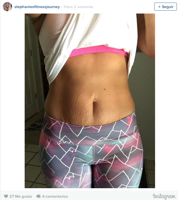 #LoveYourLines, mujeres con estrías