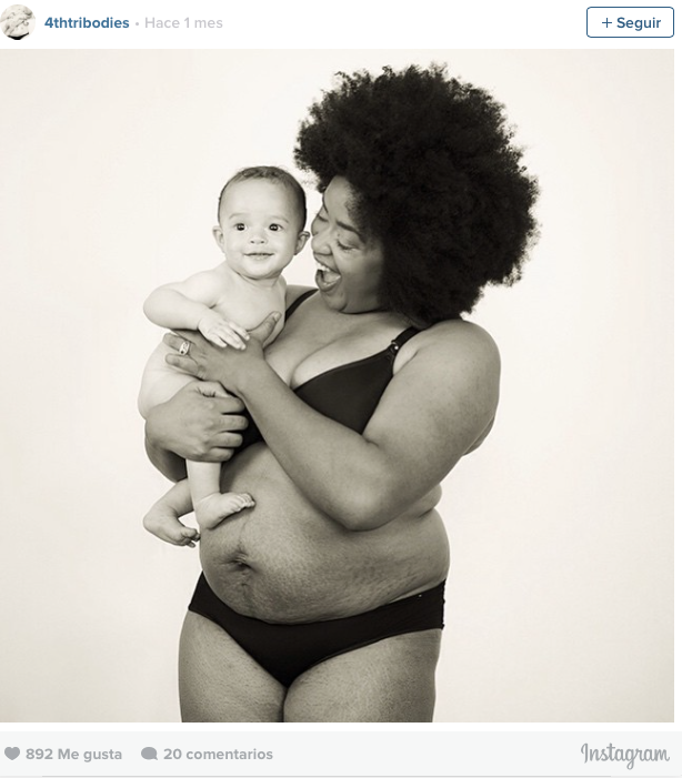 #LoveYourLines, mujeres con estrías