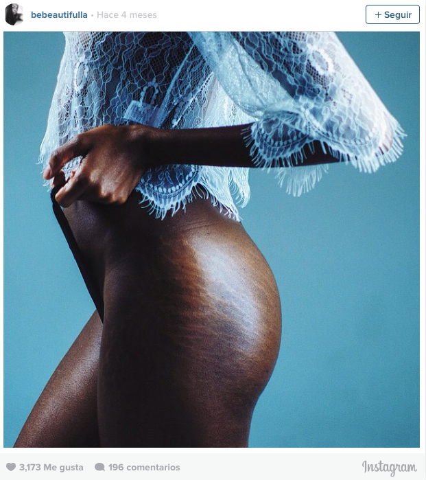 #LoveYourLines, mujeres con estrías