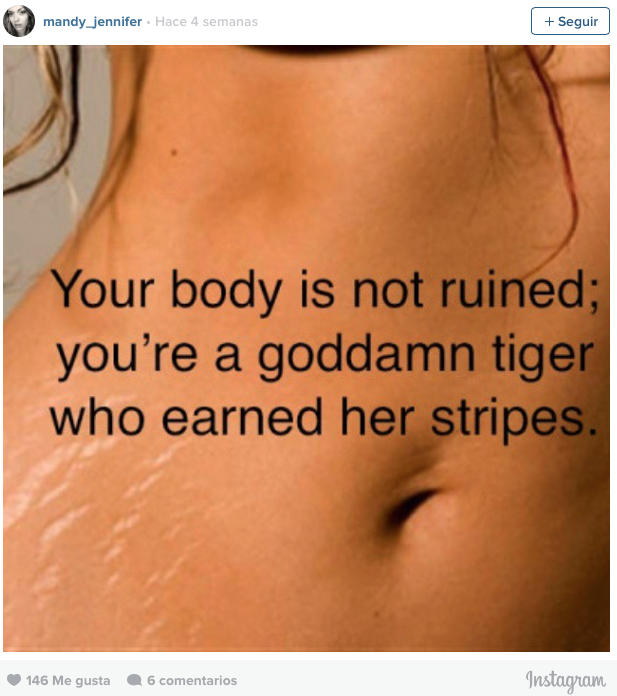 #LoveYourLines, mujeres con estrías