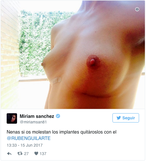 Miriam Sánchez vende sus implantes a un fan