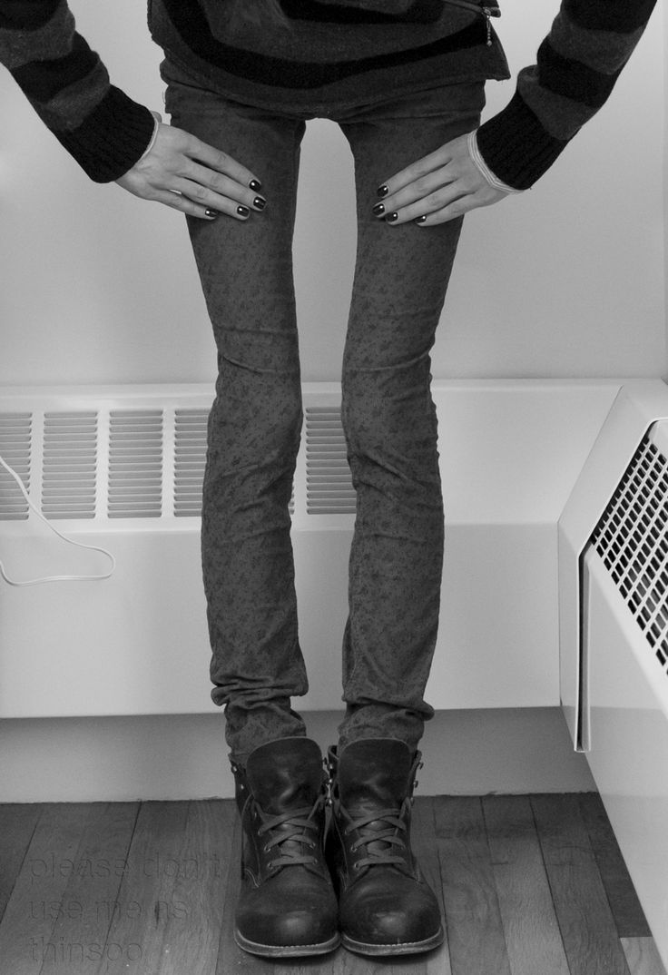 La peligrosa moda del thigh gap