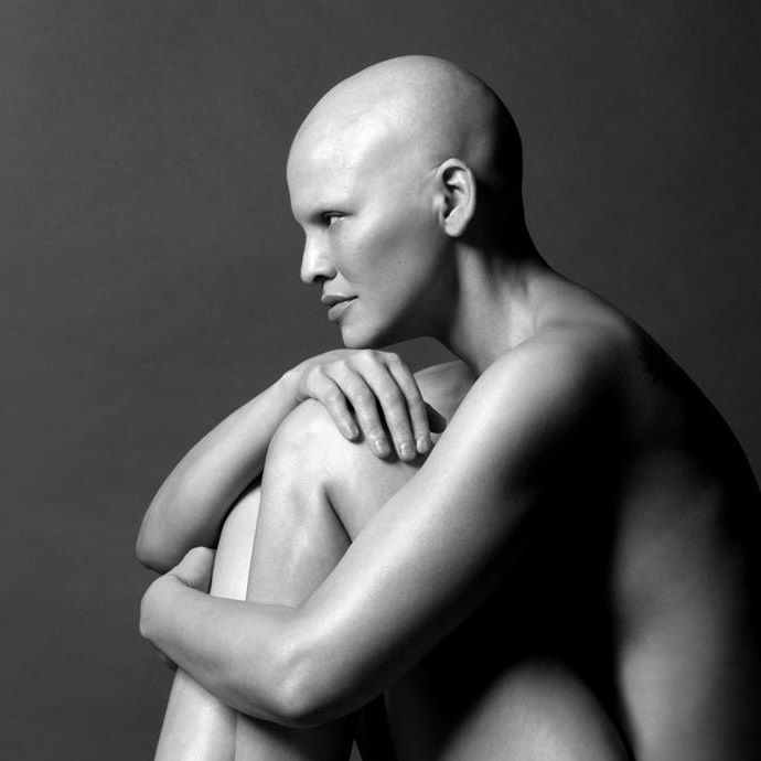 Mieko Rye, modelo con cáncer antes y después 