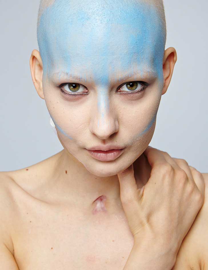 Elizaveta Bulokhova perdió la mandíbula para salvar a su hijo