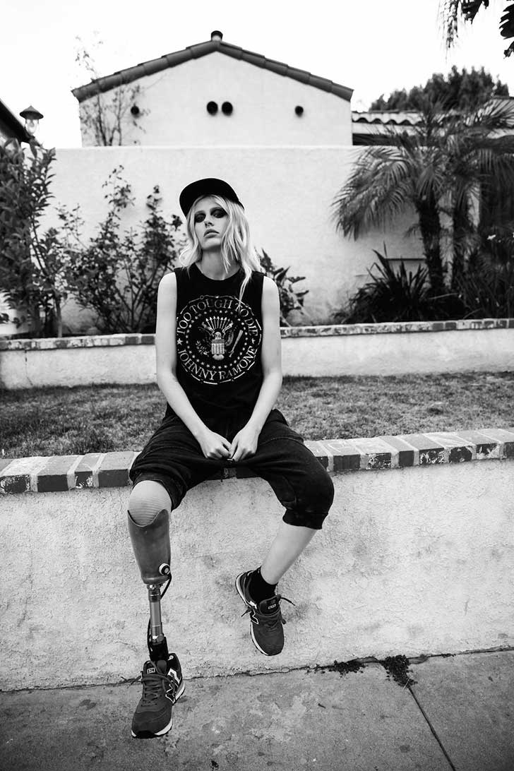 Lauren Wasser perdió una pierna por un tampón