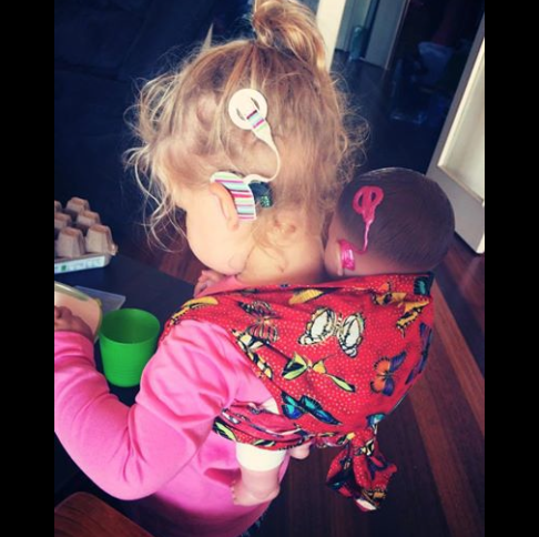 Las primeras muñecas con discapacidad