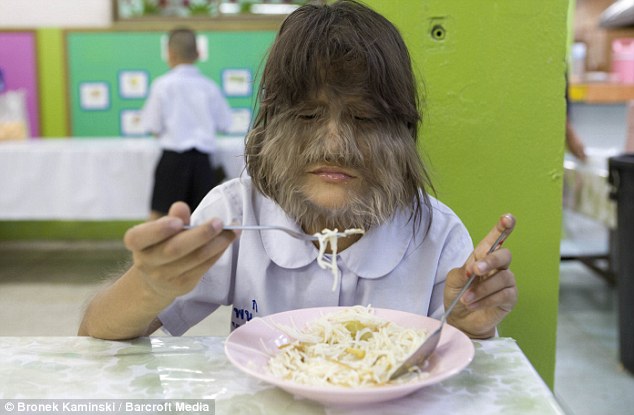 Adolescente más peluda del mundo 