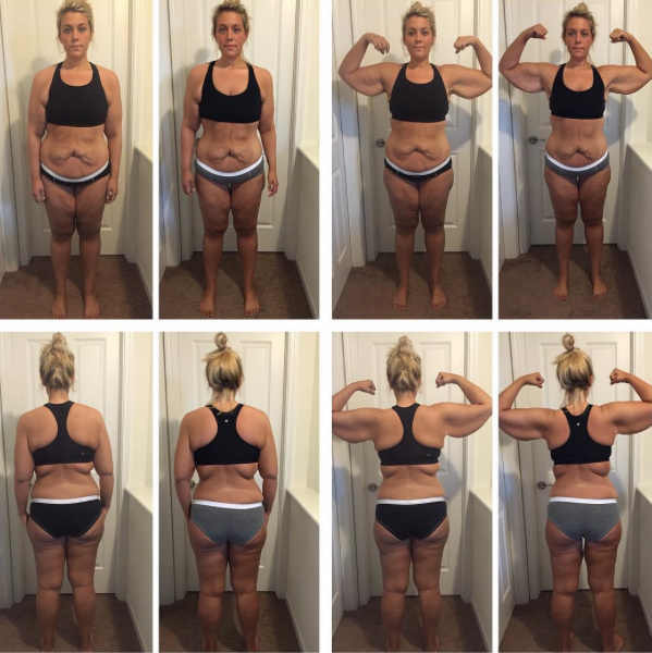 Mujer pierde 70 kilos 