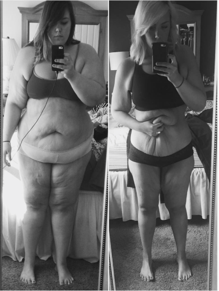 Mujer pierde 70 kilos 
