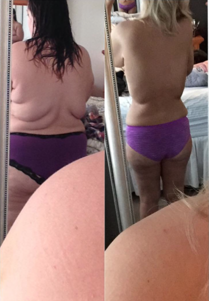 Mujer pierde 70 kilos 