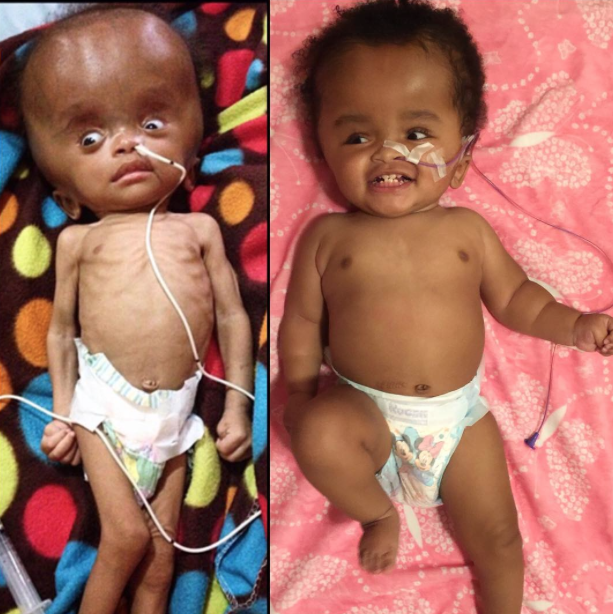 Niña rescatada de la basura en Haití