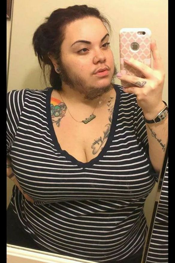 Esta chica decidió aceptar el vello en su cara