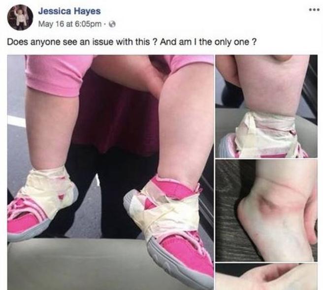 Pegan los zapatos a un bebé con cinta adhesiva