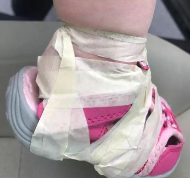 Pegan los zapatos a un bebé con cinta adhesiva