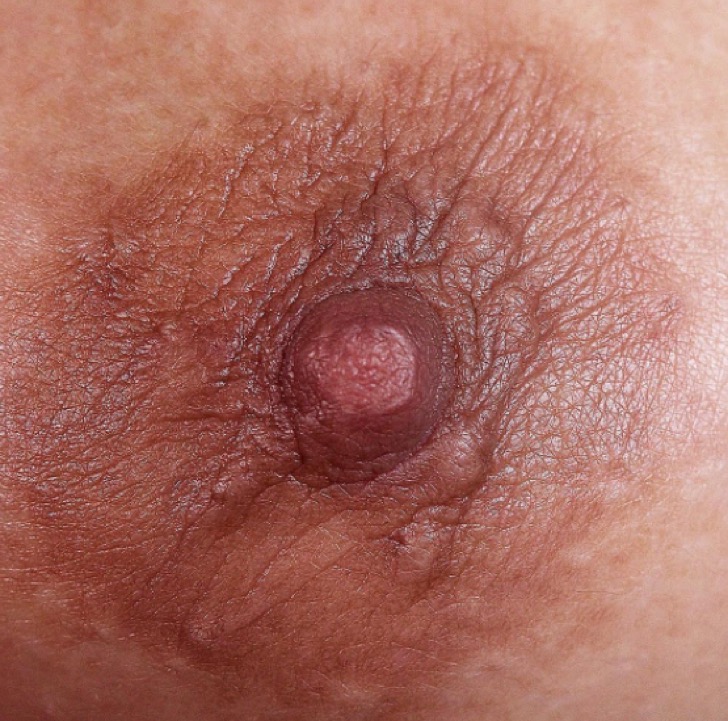 ¿Son pezones femeninos o masculinos?