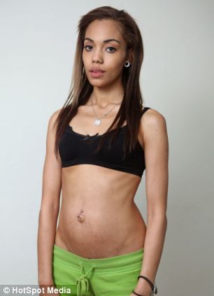 Holly Griffith, madre con pregorexia