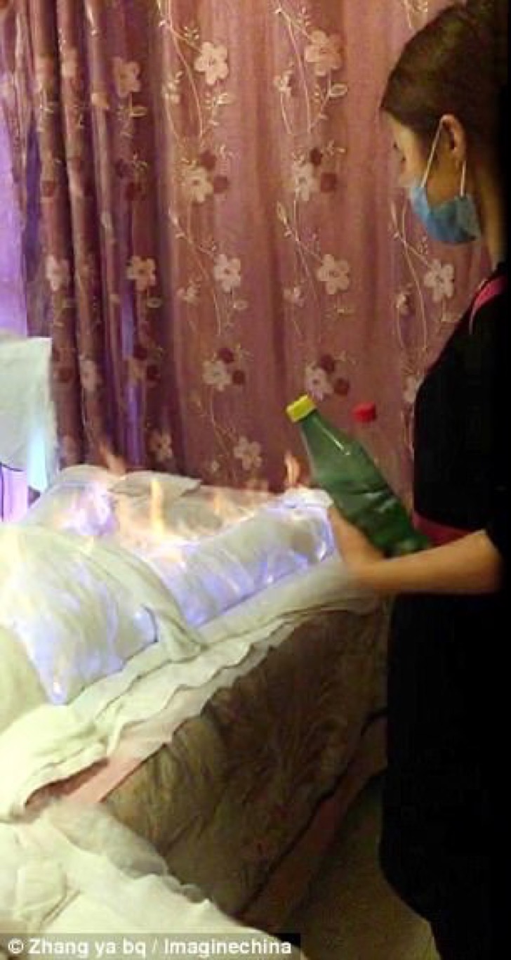 Quemarte para adelgazar