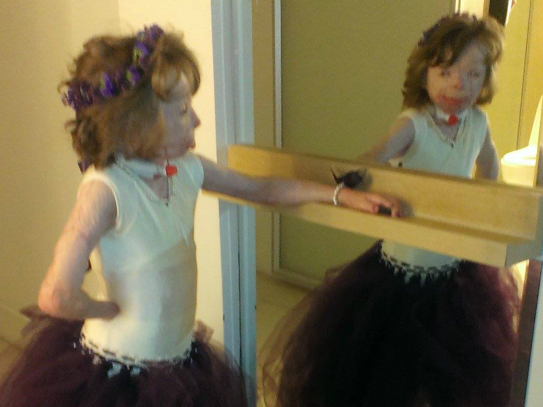 Niña quemada en un incendio pide tarjetas por Navidad