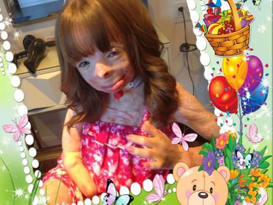 Niña quemada en un incendio pide tarjetas por Navidad