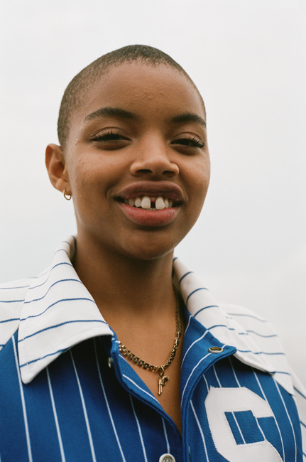 Slick Woods, la modelo imperfecta que quieren todas las firmas