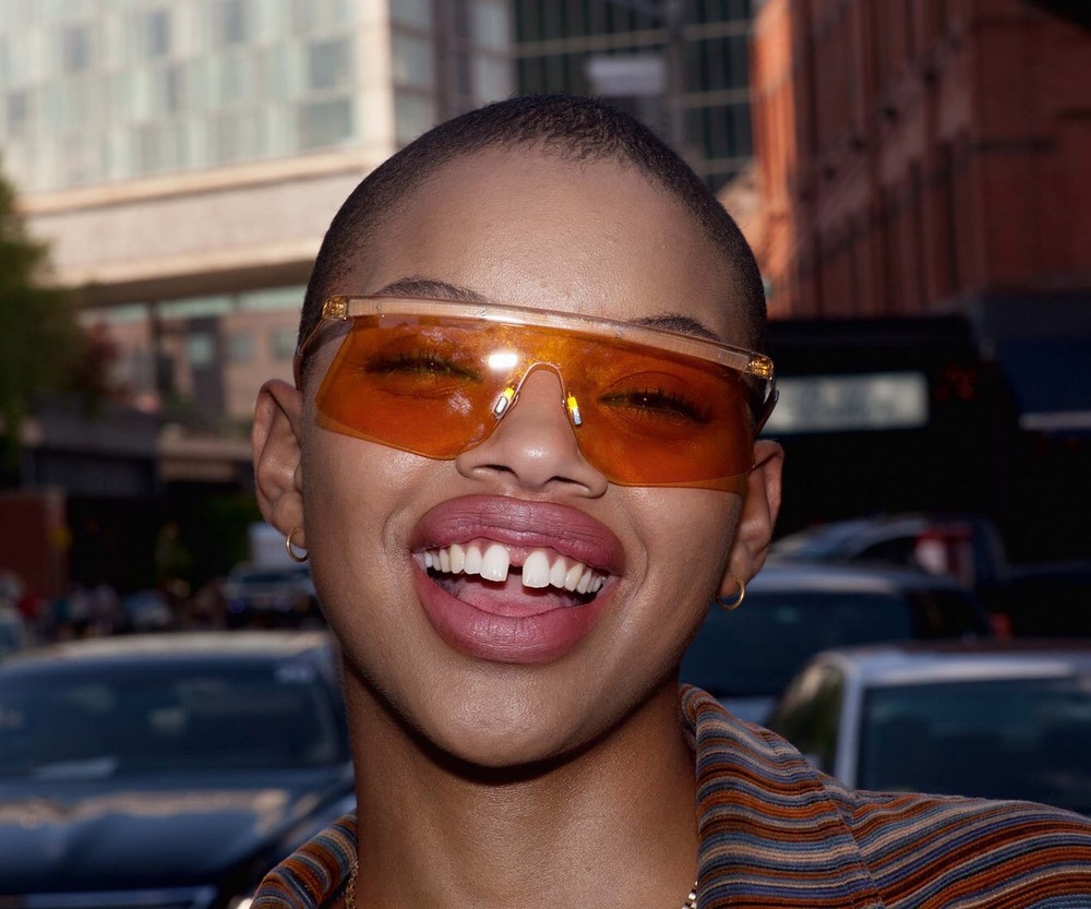 Slick Woods, la modelo imperfecta que quieren todas las firmas