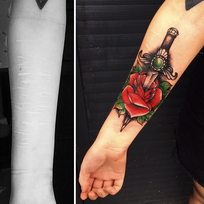 Tatuador oculta las cicatrices de autolesiones