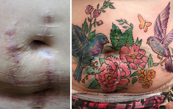 Esta tatuadora tapa cicatrices de mujeres maltratadas