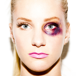 El maquillaje de la polémica: una de las actrices de Glee con un ojo morado