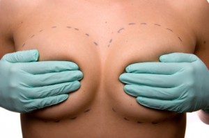 Prohiben en Francia los implantes mamarios por mera cuestión estética
