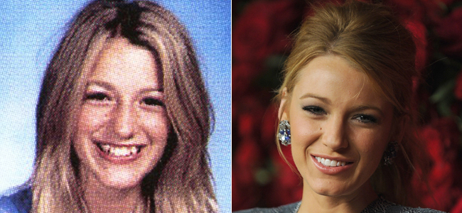 Blake Lively antes y después
