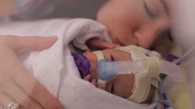 El bebe prematuro Ward Miles cumple un año en vídeo