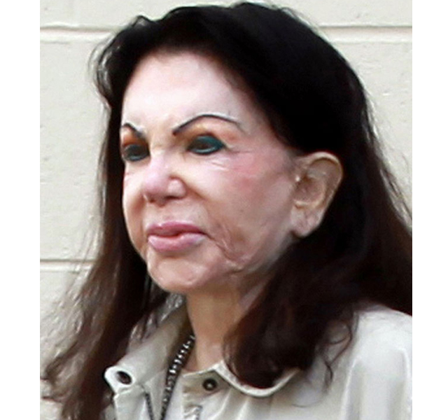 Los famosos peor operados