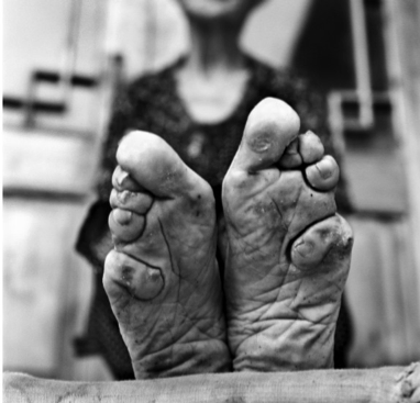 torutura de pies vendados